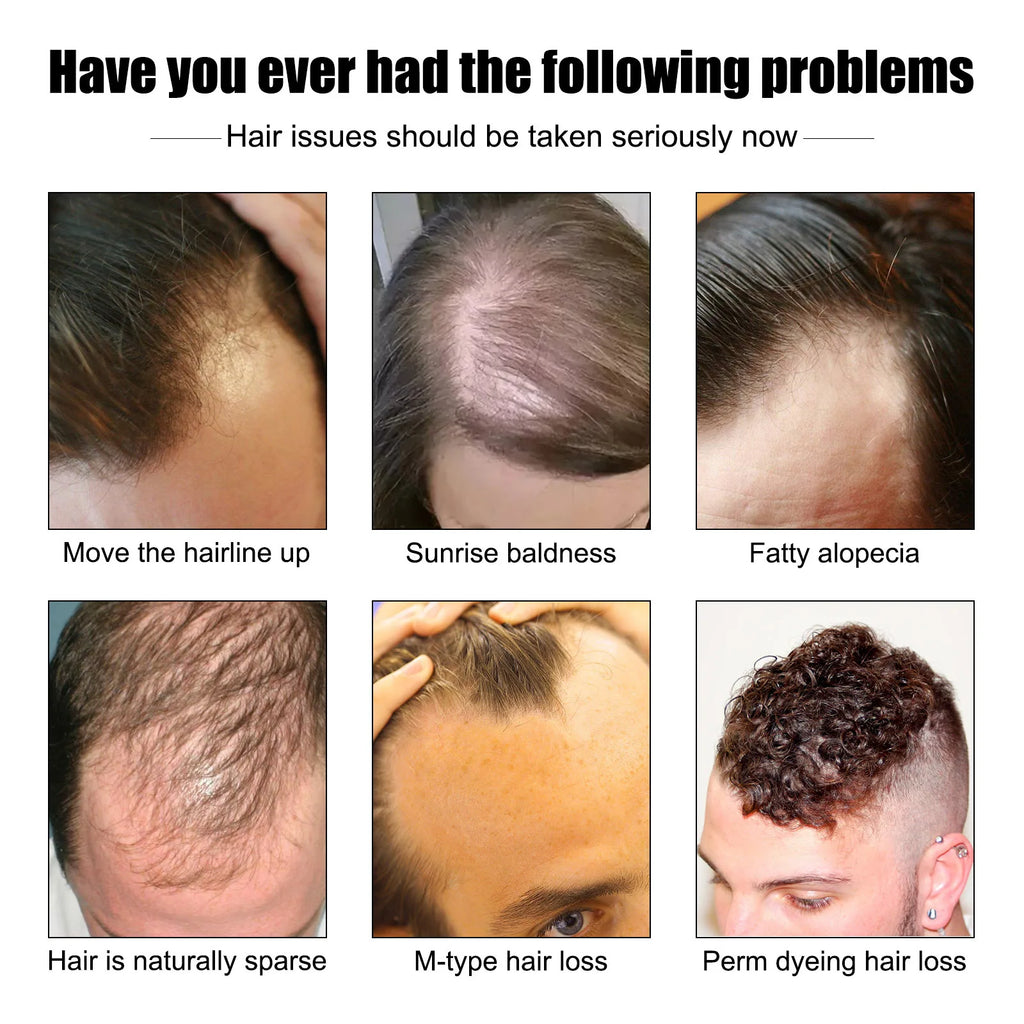 East Moon 30ml Men Hair Essence Strengthens Hair Roots Nourishes Moisturizes Scalp Fast-Absorbing, Promotes Thicker