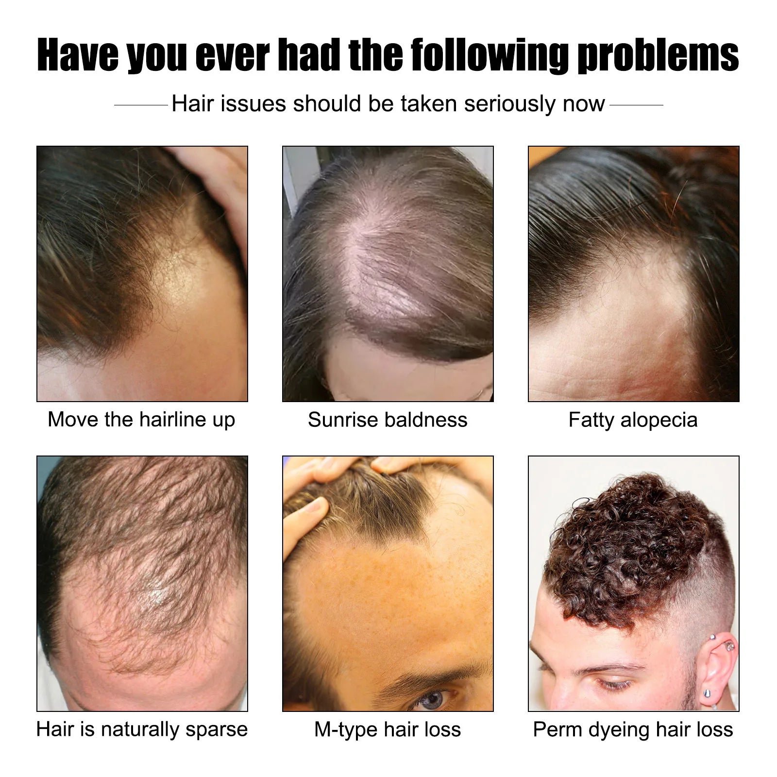 East Moon 30ml Men Hair Essence Strengthens Hair Roots Nourishes Moisturizes Scalp Fast-Absorbing, Promotes Thicker