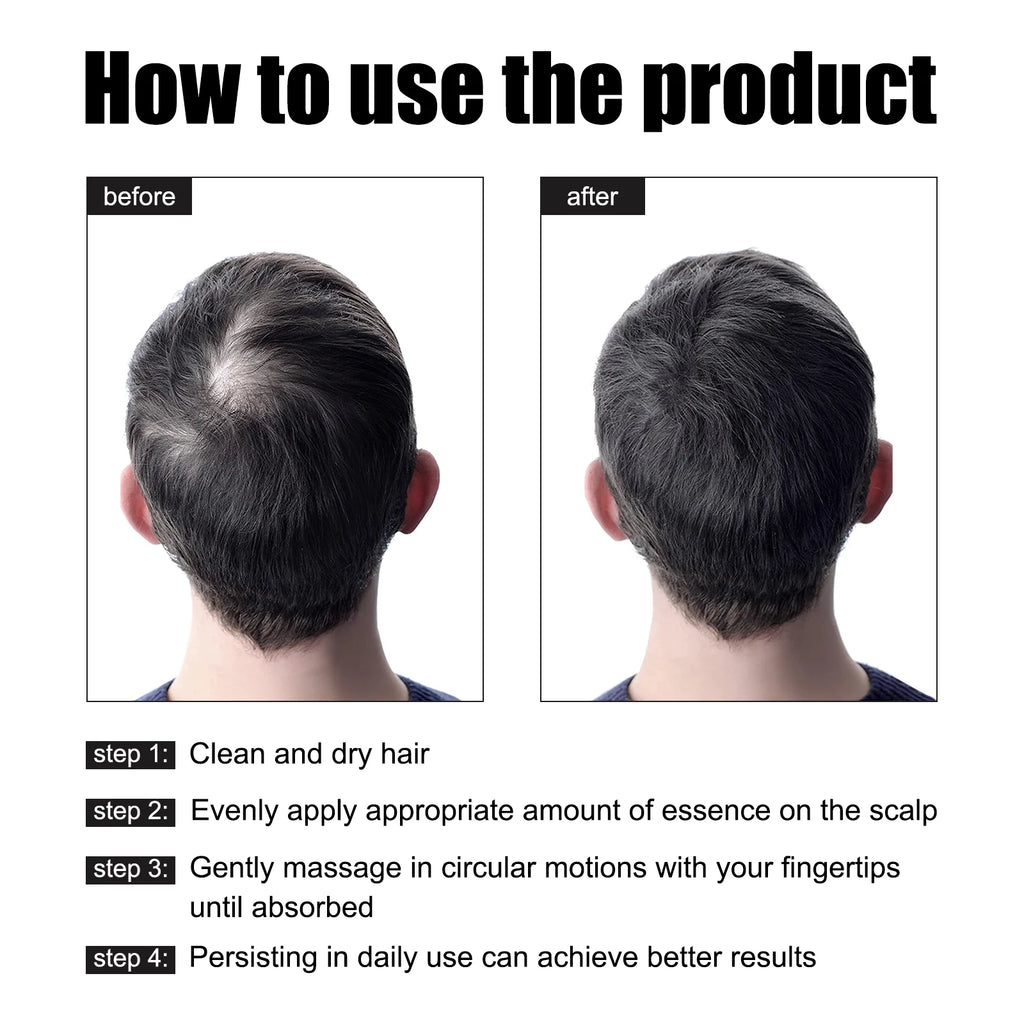 East Moon 30ml Men Hair Essence Strengthens Hair Roots Nourishes Moisturizes Scalp Fast-Absorbing, Promotes Thicker