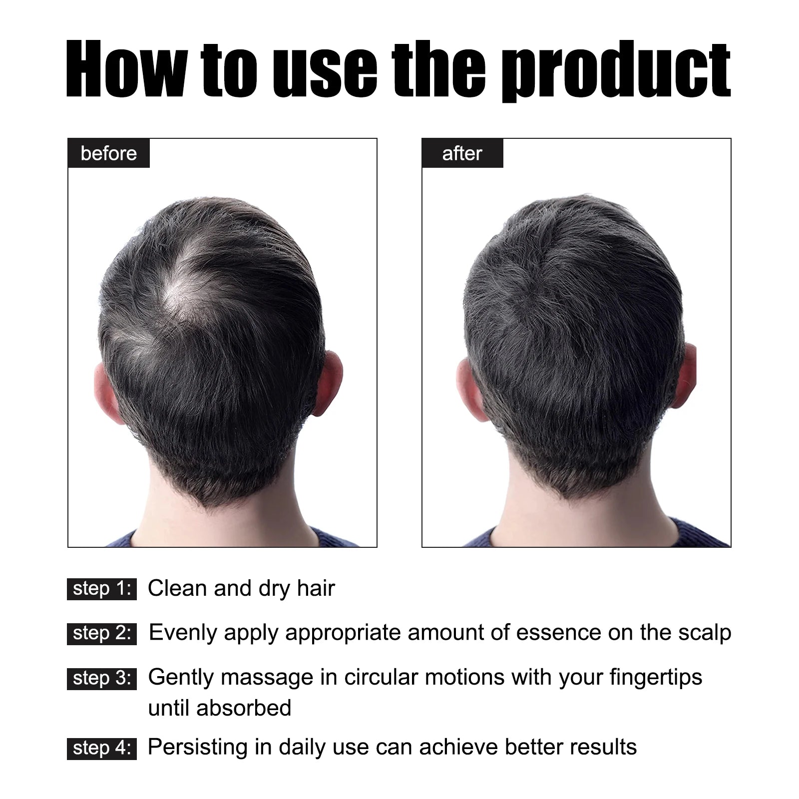 East Moon 30ml Men Hair Essence Strengthens Hair Roots Nourishes Moisturizes Scalp Fast-Absorbing, Promotes Thicker