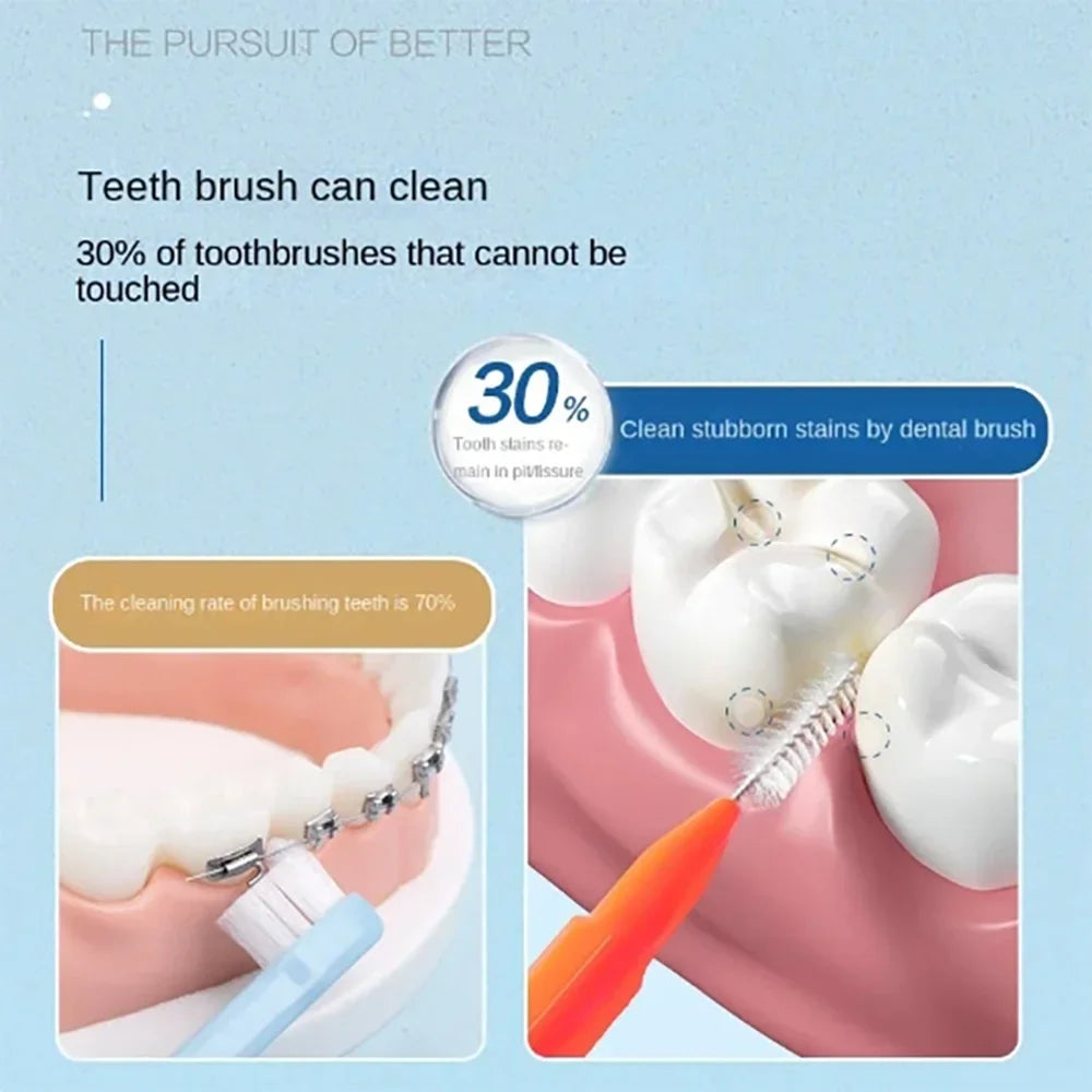 30pcs Interdental Brushes Dental Brush Between Teeth For Dental Orthodontic Clean Between Teeth Cleaning Tools Soft Brushes