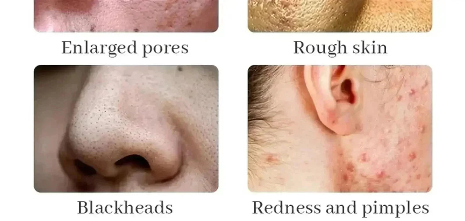 Lactic Acid Pore-Minimizing Serum | Firms & Hydrates Skin | Fast-Acting Essence