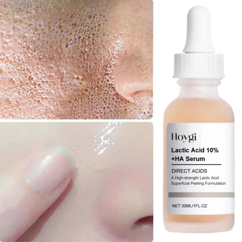 Lactic Acid Pore-Minimizing Serum | Firms & Hydrates Skin | Fast-Acting Essence