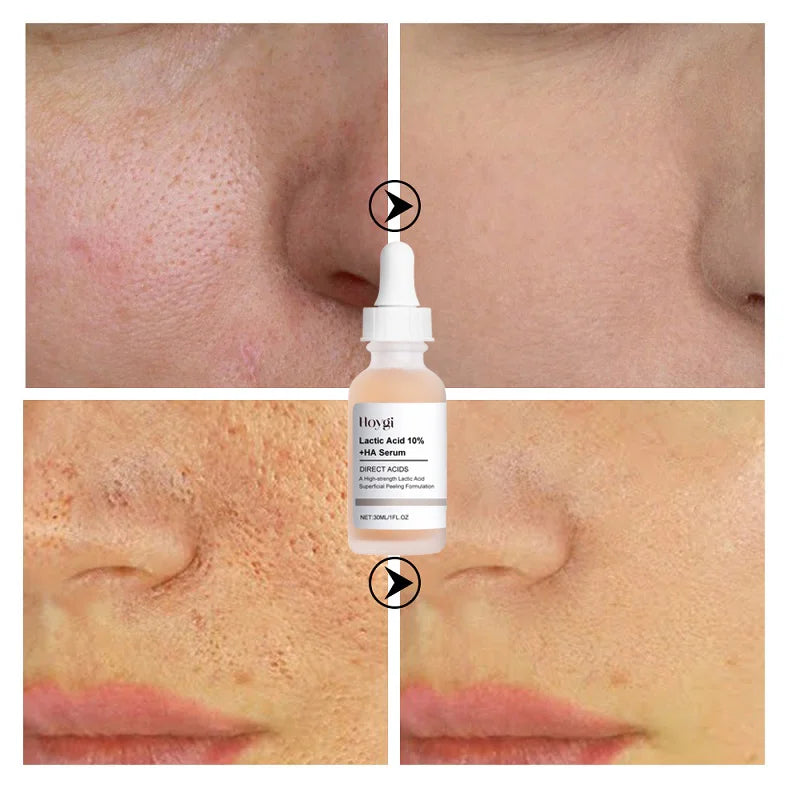 Lactic Acid Pore-Minimizing Serum | Firms & Hydrates Skin | Fast-Acting Essence