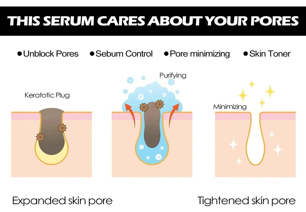 Lactic Acid Pore-Minimizing Serum | Firms & Hydrates Skin | Fast-Acting Essence