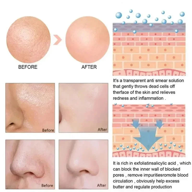 Lactic Acid Pore-Minimizing Serum | Firms & Hydrates Skin | Fast-Acting Essence