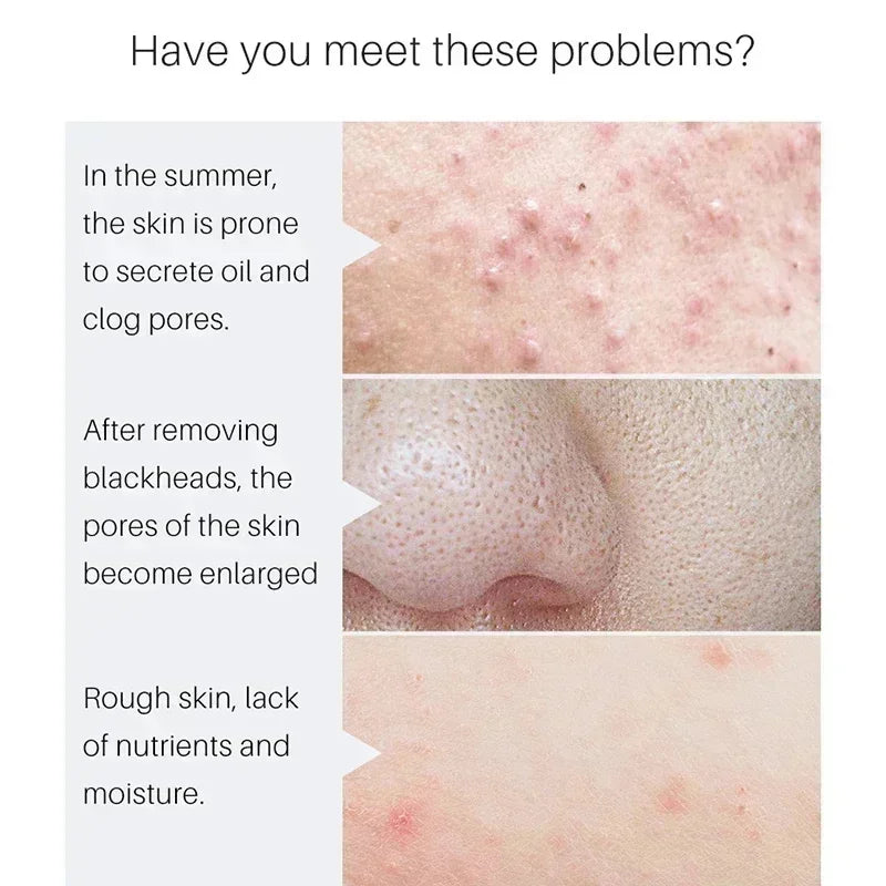 Lactic Acid Pore-Minimizing Serum | Firms & Hydrates Skin | Fast-Acting Essence