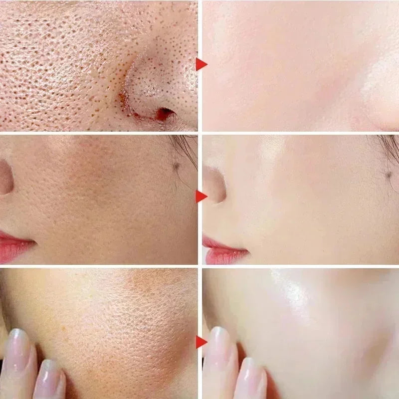 Lactic Acid Pore-Minimizing Serum | Firms & Hydrates Skin | Fast-Acting Essence