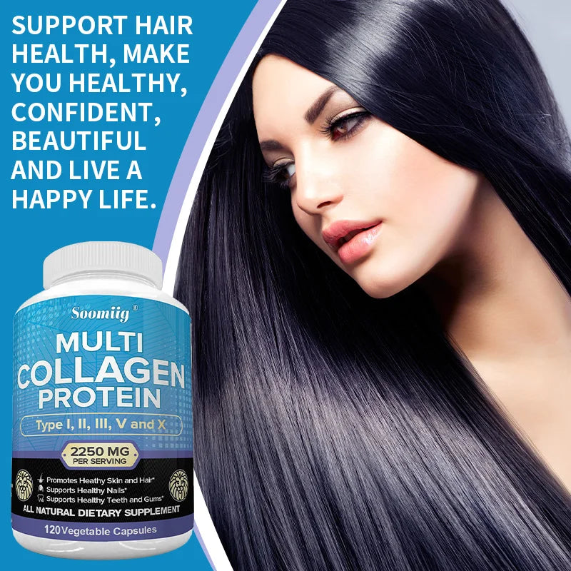 High Strength Collagen Complex - Protein Supplement for Firm Skin, Healthy Joints, Hair and Nails, 120 Capsules