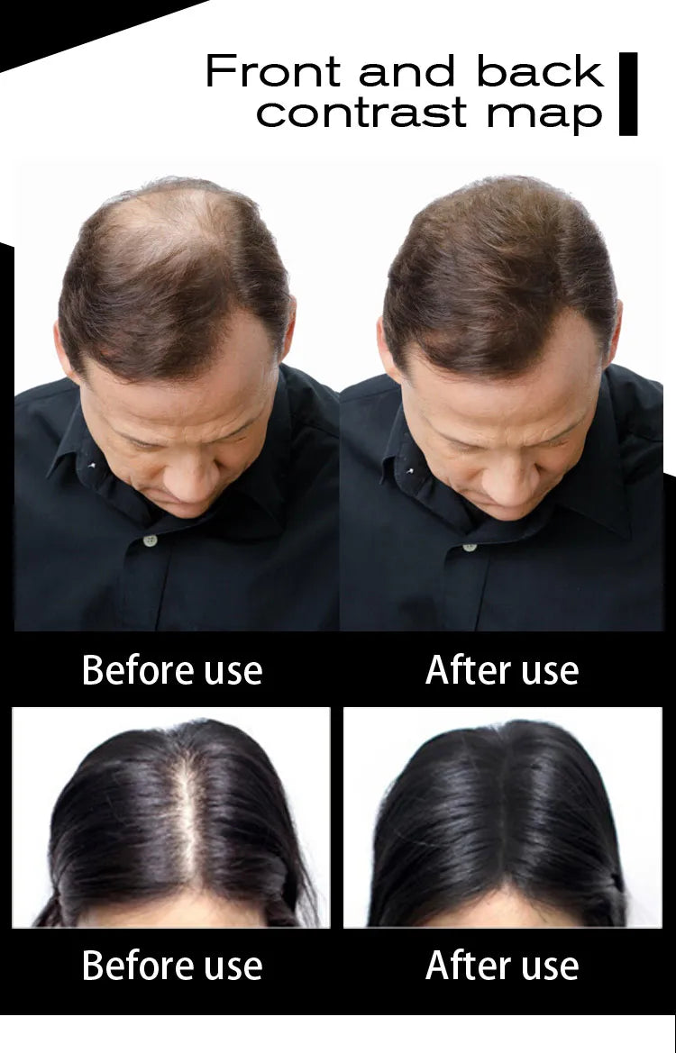 10 Color Keratin Hair Building Fiber Hair Loss Fiber Natural Hair Thickening Fibers Concealer Refill Anti Hair Loss Products